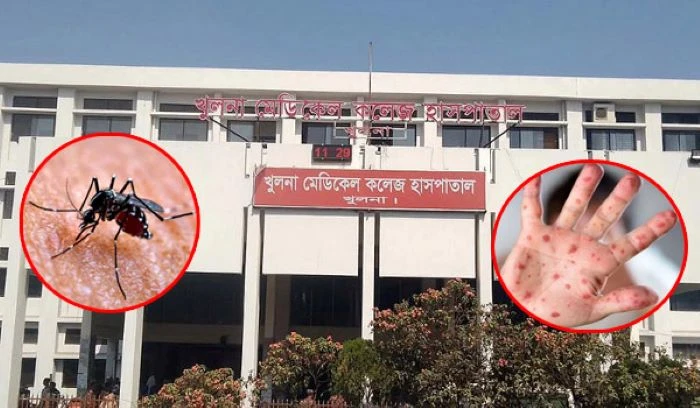 খুলনায় ডেঙ্গু-হামের ভয়াবহ থাবা : ২৪ ঘণ্টায় ডেঙ্গুতে ২ ও হামে ১ জনের মৃত্যু, হাসপাতালে নতুন ১৭৮ রোগী